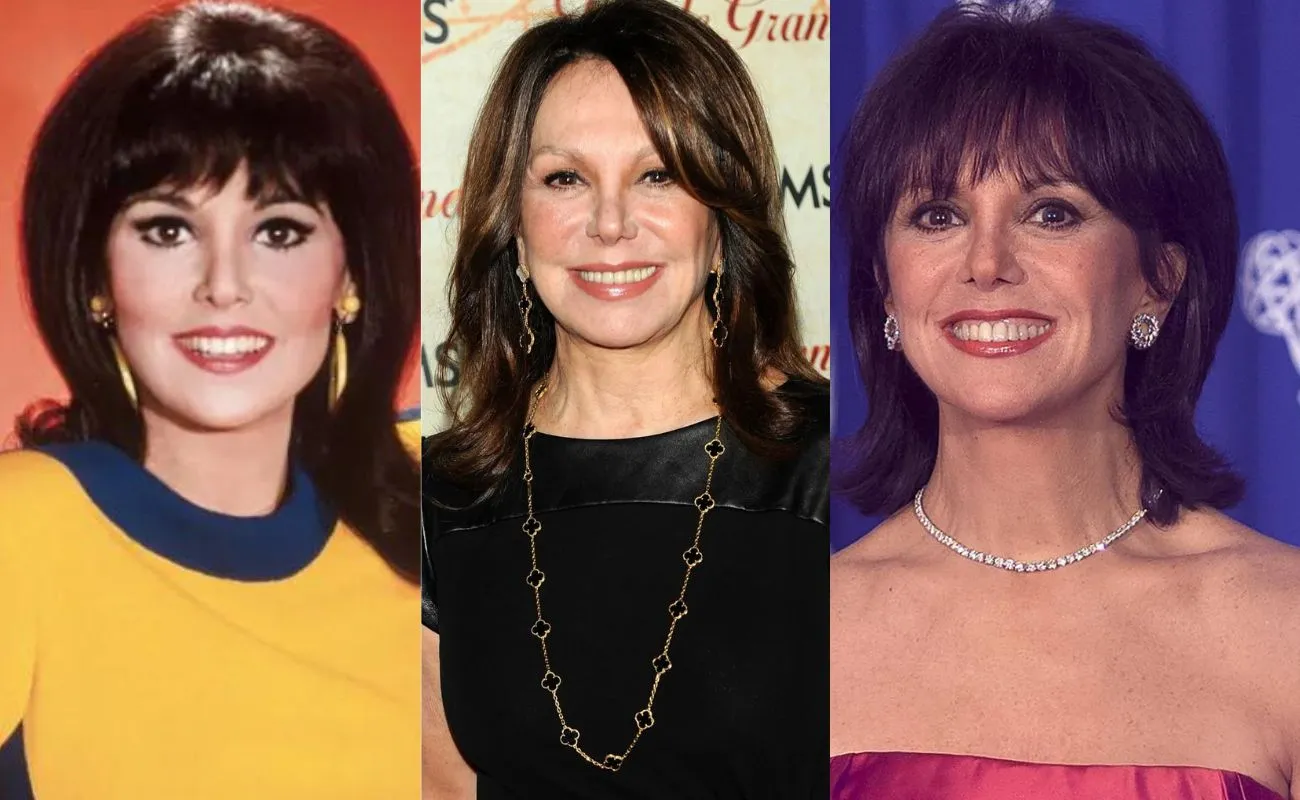 Has ‘That Girl’ Actress Marlo Thomas Had Plastic Surgery?